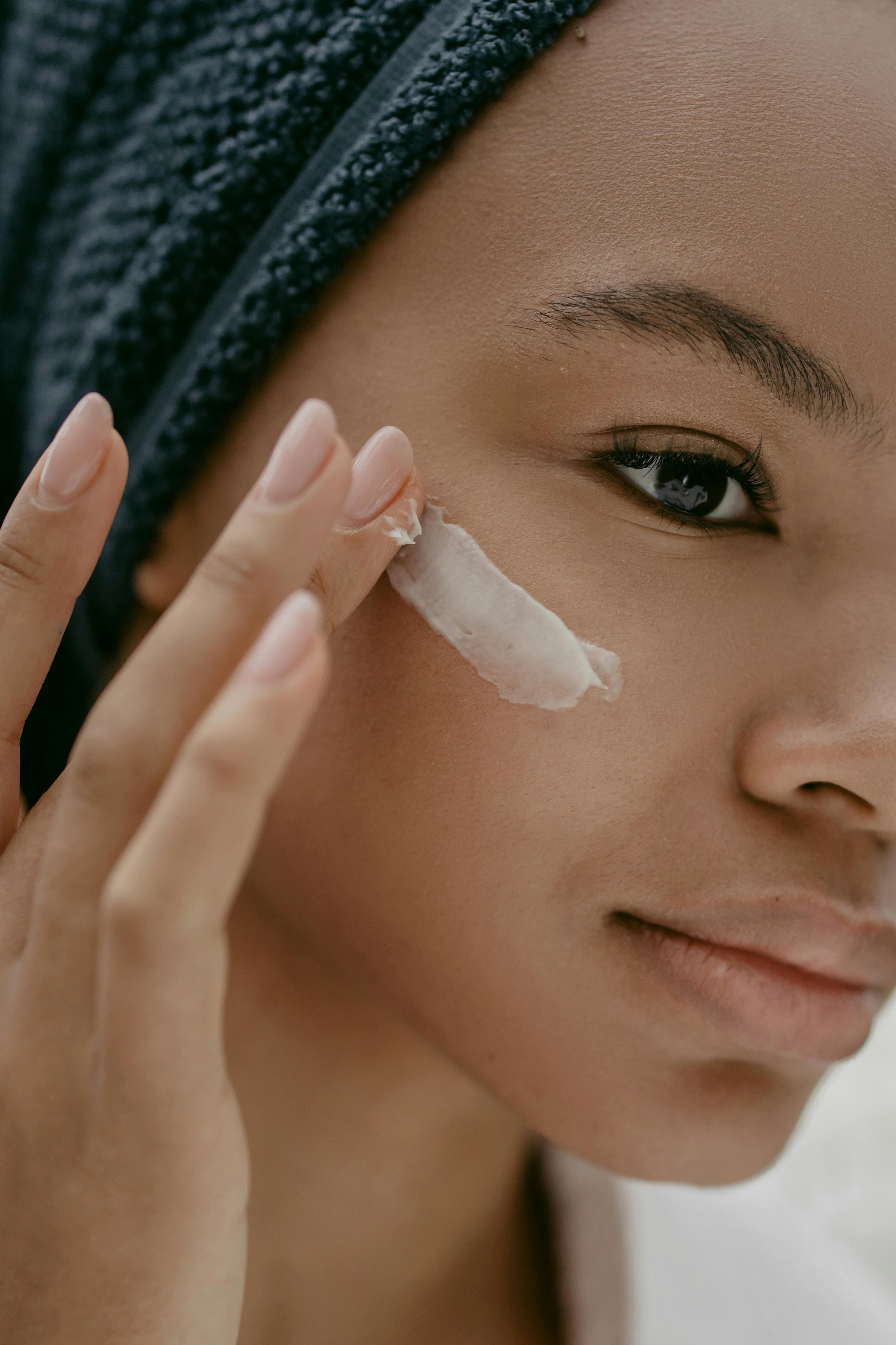 Tratamento para acne — benefício 1