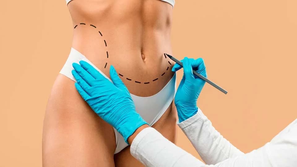 Tratamento para flacidez — como funciona, etapa 1