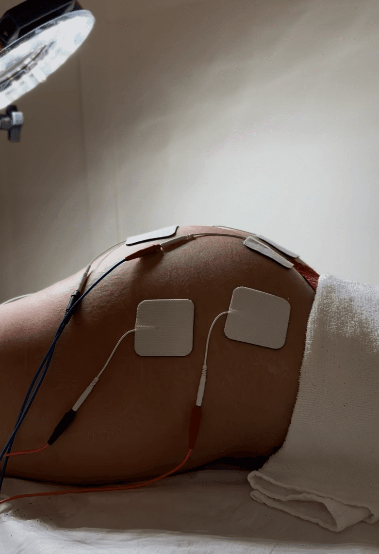 Protocolos para melhorar firmeza e definição respeitando o ritmo do seu corpo. — região tratada, imagem 2